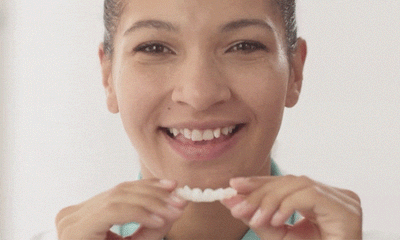 Facettes dentaires à clipser Isoria™